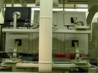 Rear view of Modalixx G202MG LCDs upgrade with Ampronix model #17AMS2L mounts on Siemens Bi-Cor model bi-plane cath lab