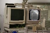  Philips Integris model cath lab room view with CRTs model #TG21CM before upgrade to Modalixx LCDs